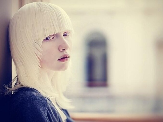 Кто такие альбиносы: признаки. Сколько лет живут альбиносы люди, почему они долго не живут?