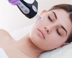 Facial dermabise - aesthetic laser grinding of face: views, price, result, photo