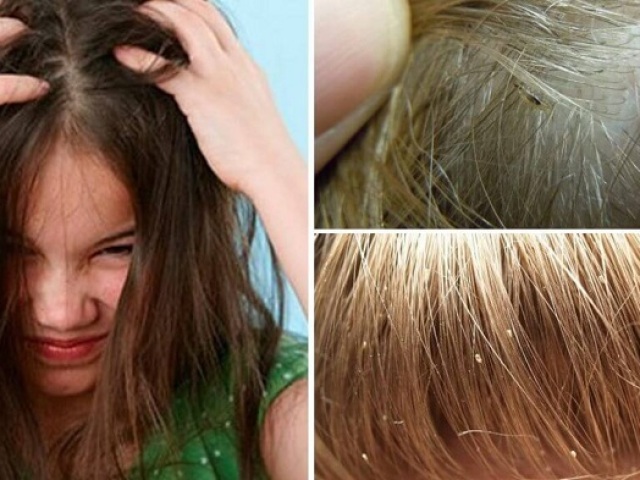 How many lice and nits live without a person’s head?