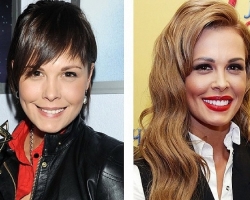 Plastic surgery of Russian stars: photo before and after