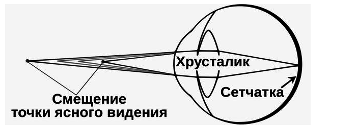 Ближняя точка. Точка ясного видения. Ближняя точка ясного видения. Ближайшая точка ясного зрения. Ближайшая точка ясного видения.