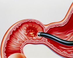 How to check the duodenum: what analysis to pass, instrumental methods