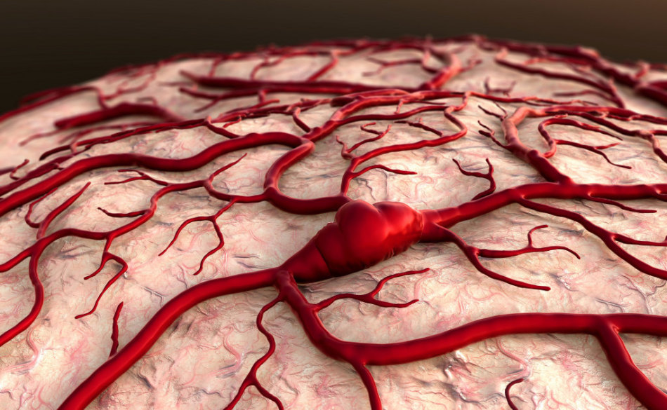 La pathologie vasculaire peut provoquer une paresthésie