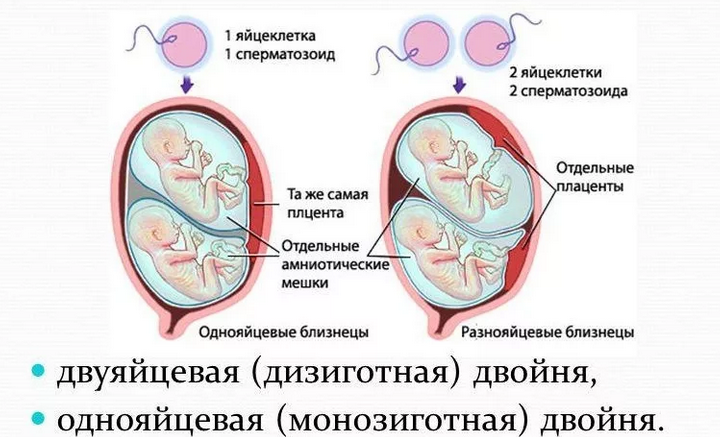 Двойняшки и близняшки