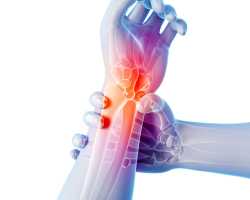 Arthritis and arthrosis of the joints: treatment with medical drugs, herbs, folk remedies, exercises, massage, compresses, diet, prevention. Which doctor treats arthritis and arthrosis of the joints?