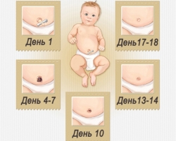 Novorojenček ima popk: kaj storiti? Kako obdelati popk v novorojenčku? Zakaj je popk pri novorojenčkih moker in kri?