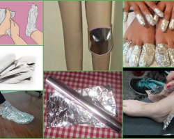 Foil treatment of joints. How to treat your back, a bone on your leg, arthritis and arthrosis? Which side to apply foil for treatment with baking joints of the joints?