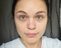 Recipes for effective masks from bruises under the eyes at home: how to remove?