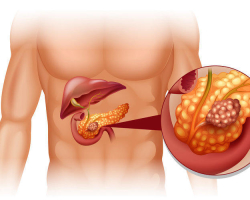 Where is the pancreas, what are its normal sizes, functions in the body in humans, possible diseases: description