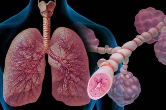 Antibiotiques dans l'asthme bronchique chez les adultes