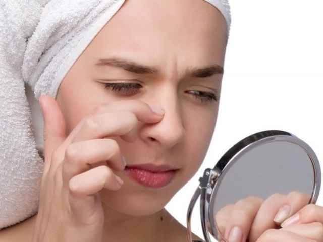 Az orr pattanása: A nők és a férfiak okai. Hogyan lehet megszabadulni az orr pattanásaitól egy nap alatt?