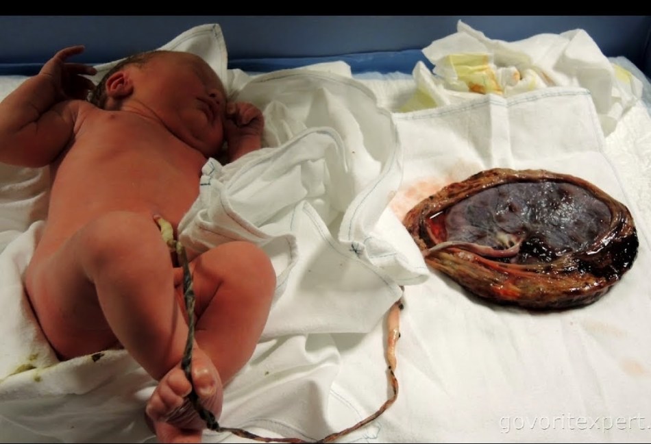 Naissance du lotus, enfant et placenta