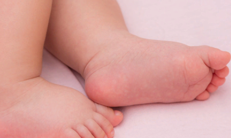 Покраснения и зуд между пальцев на ногах у ребенка: причины, диагностика, какой врач лечит?