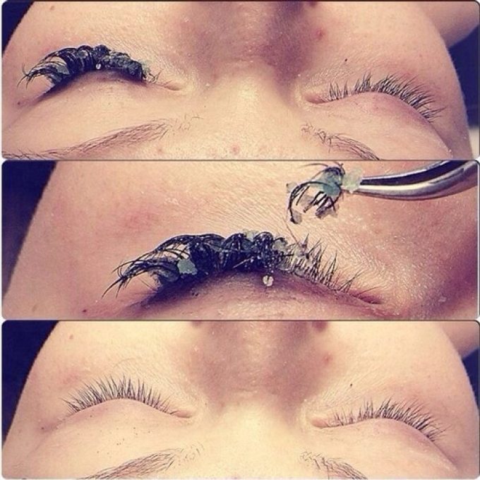 Removing extended eyelashes with a remover.
