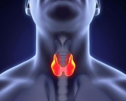 Types de maladies thyroïdiennes: Quelles sont-elles dangereuses, quelles conséquences peuvent être?