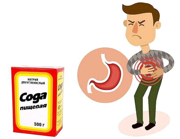 Soda solution at home for drinking from heartburn