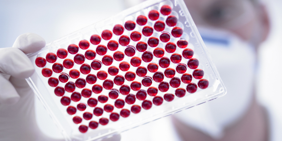 Krvni test bo pokazal prisotnost ali odsotnost nosečega protitelesa do klamidije.