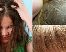 How many lice and nits live without a person’s head?