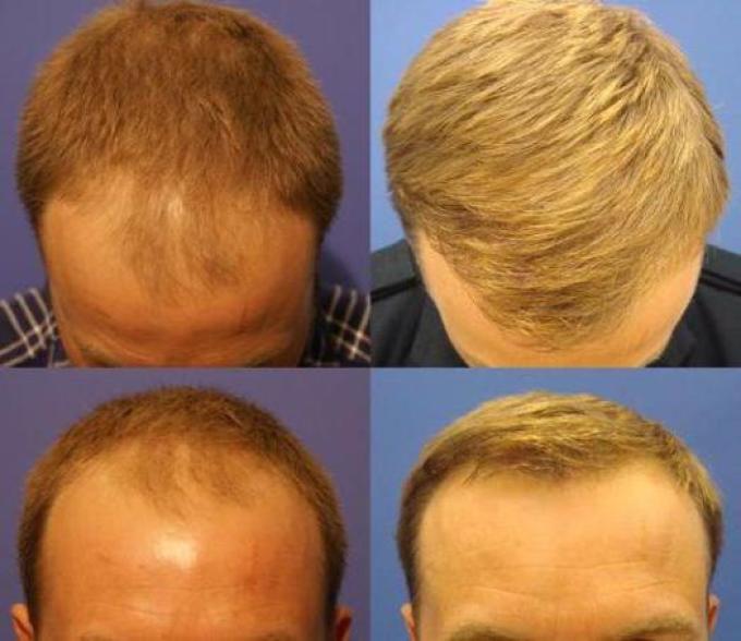 Эффект действия hair megaspray